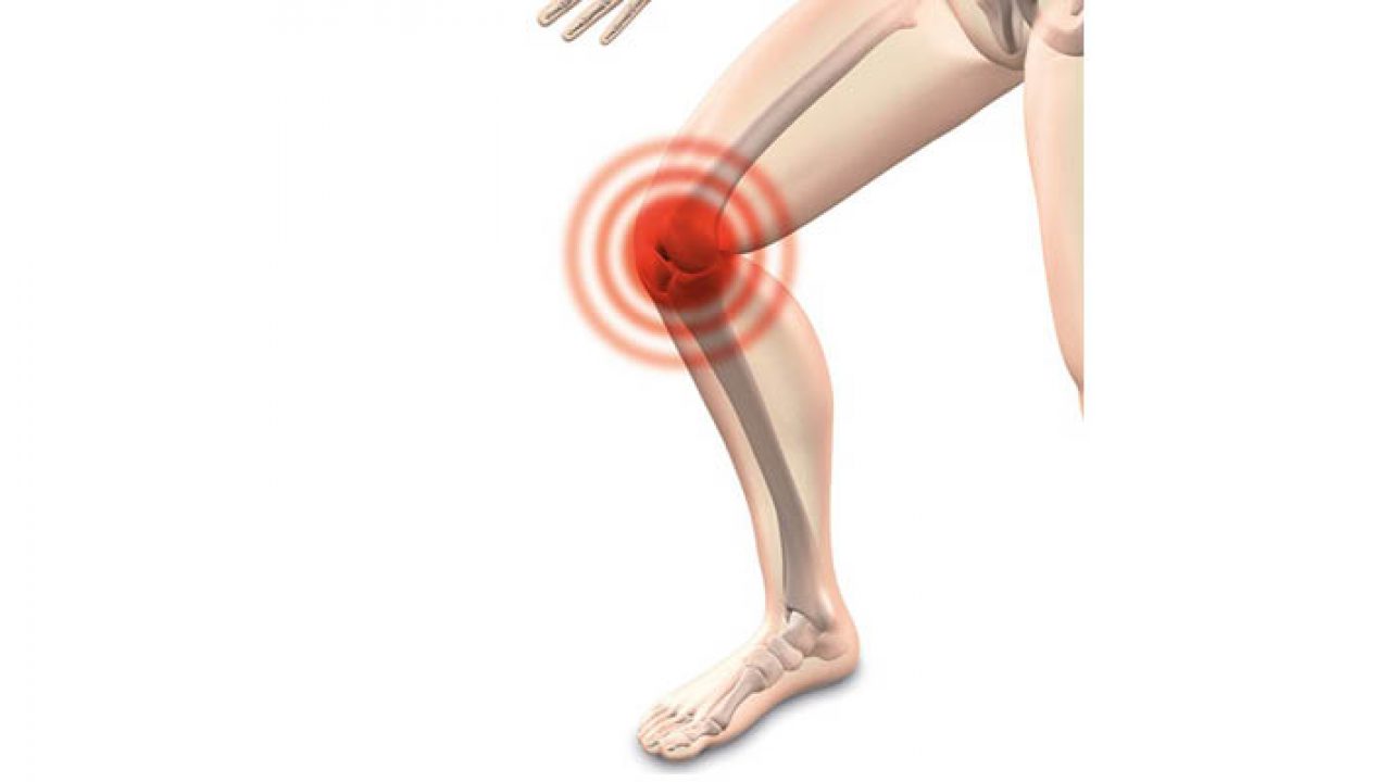 legering Wrijven Denk vooruit Pijn aan de binnenkant van de knie - fysiotherapie & fitness